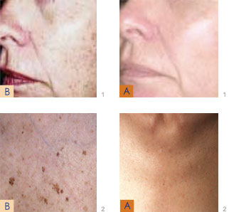 Before and After Photos